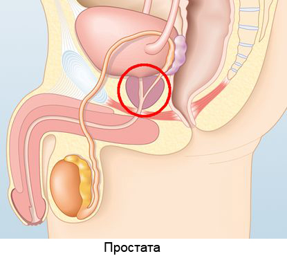 простата.jpg