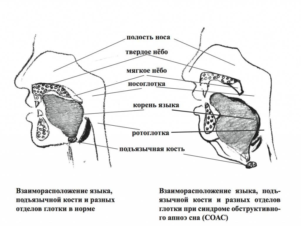 положение языка