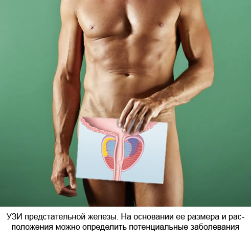 предстательная железа.jpg